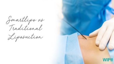 Photo of Benefits of Liposuction – The most effective ones! 