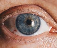 Photo of CONTROLLING BLEPHARITIS BEFORE IT BECOMES A COMPLICATION